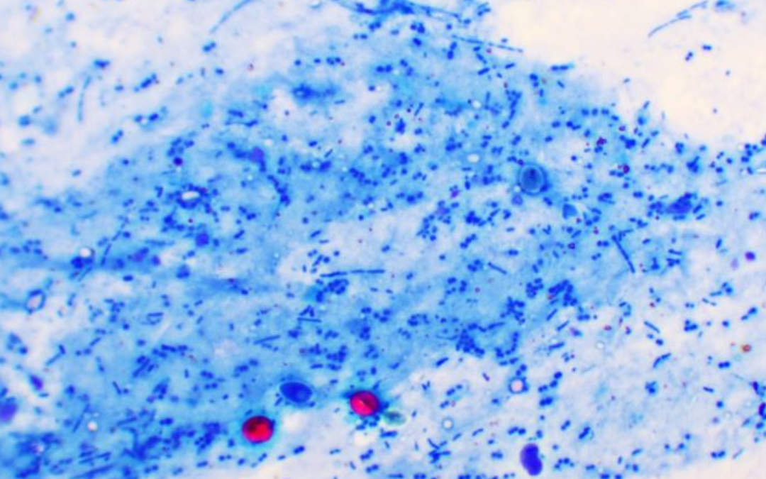 Do Water Filters Remove Cryptosporidium?